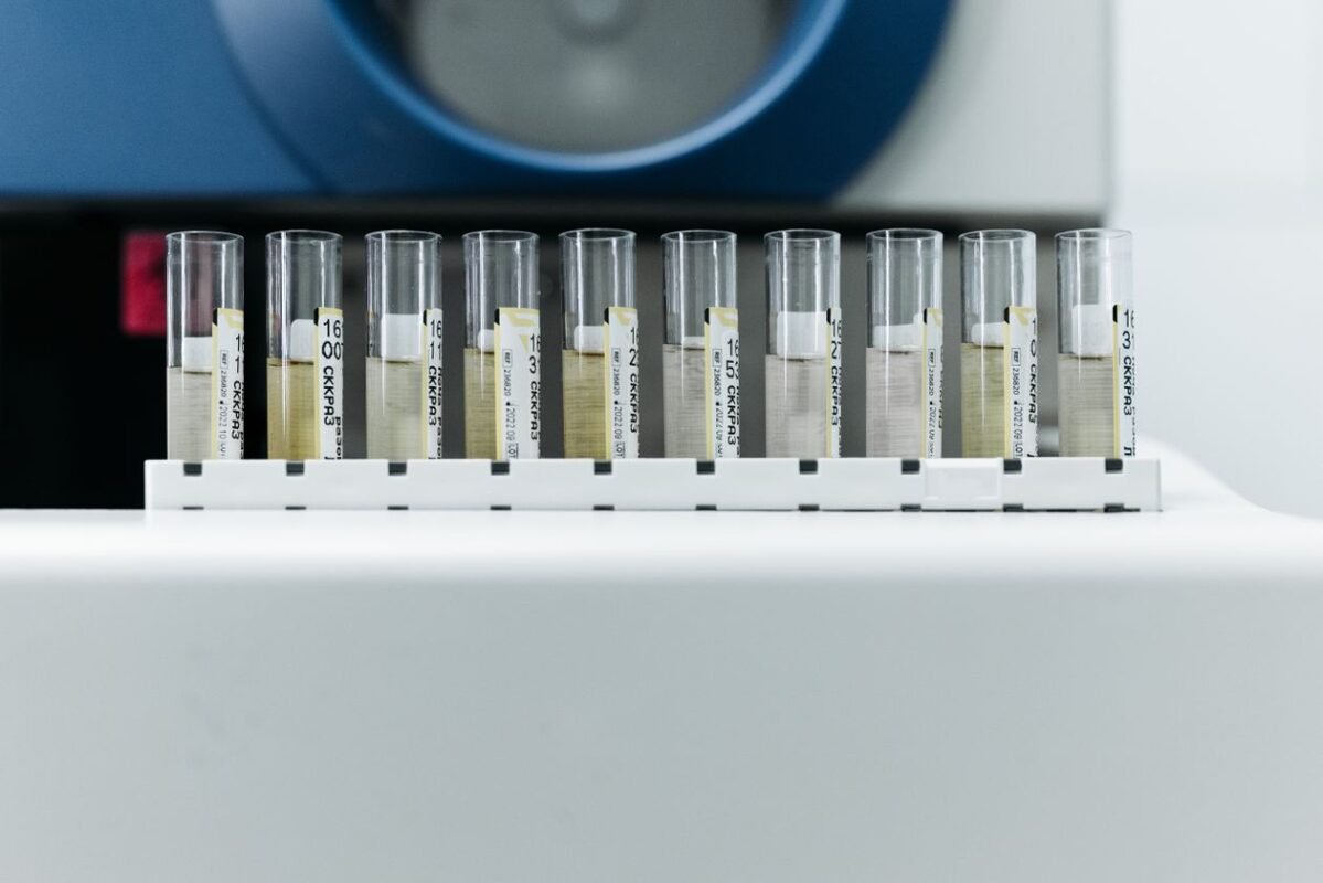 Row of labelled sample tubes in a testing laboratory